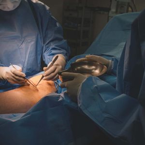 Saving Limbs and Lives: Stories from Vascular Surgeons